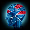 Severe Intracranial Pressure Treatment Off With The Skull