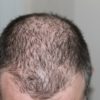 hair 248050 1920 1