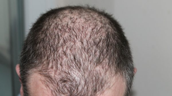 hair 248050 1920 1