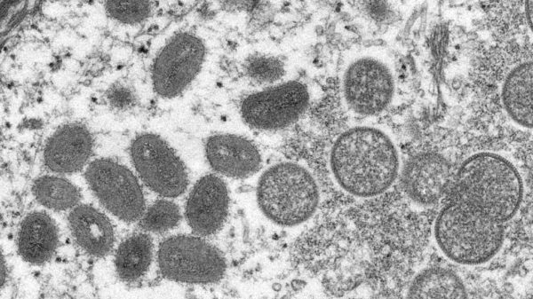 Why monkeypox might soon get a new name Health