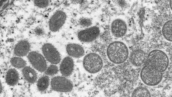 New York stresses monkeypox vaccine urgency as cases rise