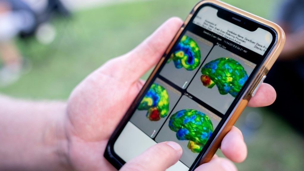 Study on serotonin and depression sparks heated debate - Health and Lifestyle News - Report by AFR | Online Free Press release news distribution - Vimarsana News