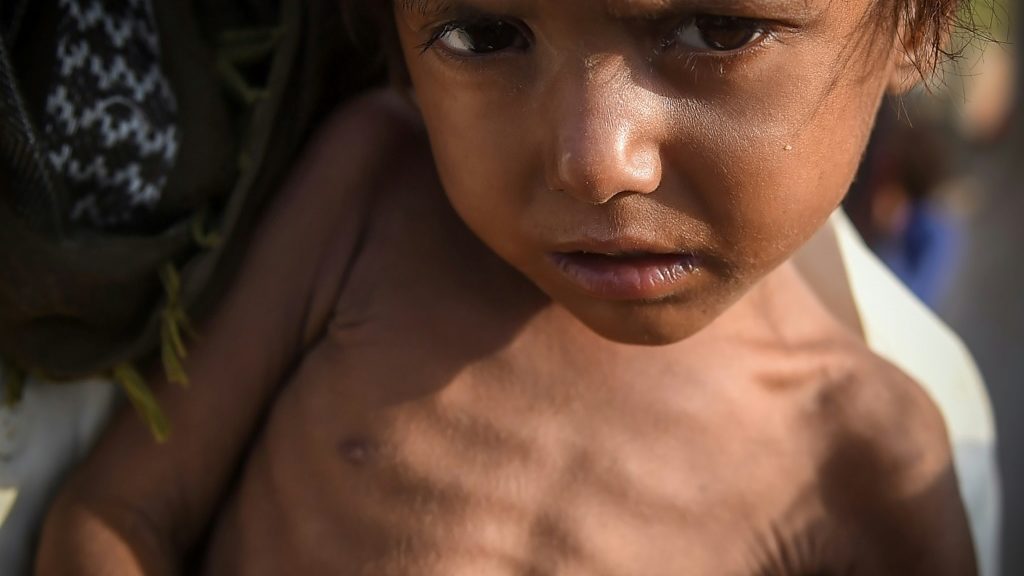 After the floods, a wave of disease plagues Pakistan - Science-Environment News - Report by AFR | Online Free Press release news distribution - Vimarsana News